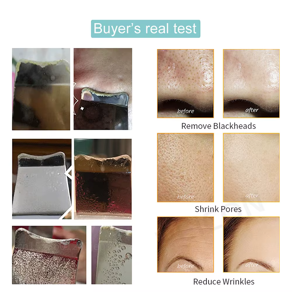 Ultimativer Ultraschall Hautwäscher mit Peeling und Mitesserentfernung für eine tiefgehende Gesichtsreinigung und strahlende Haut – Bild 7